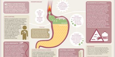 Heartburn Explained {Infographic}