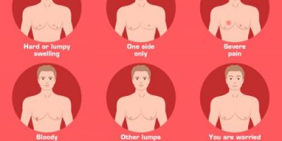 What Is Gynecomastia? [Infographic]