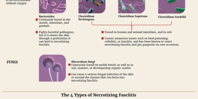 Microbes That Cause Flesh Eating Disease [Infographic]