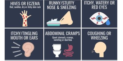 Food Allergies: Symptoms to Watch for [Infographic]